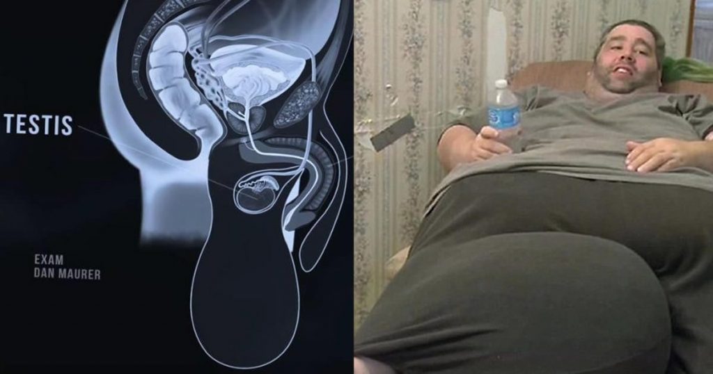 L'incredibile storia di Dan Maurer, l'uomo dai testicoli enormi