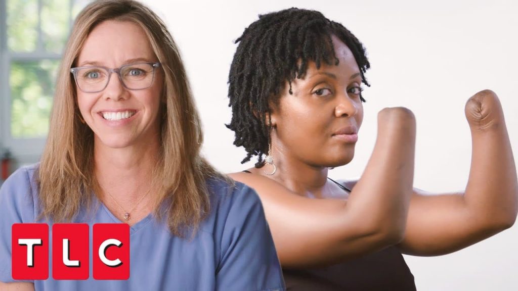 Allison Vest, chi è davvero la dottoressa che fa miracoli con le protesi